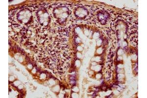 IHC image of ABIN7153827 diluted at 1:400 and staining in paraffin-embedded human small intestine tissue performed on a Leica BondTM system. (RABGGTB 抗体  (AA 2-331))