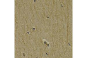 Immunohistochemistry (IHC) image for anti-Dopamine Receptor D3 (DRD3) (AA 213-329) antibody (ABIN3015510) (DRD3 抗体  (AA 213-329))