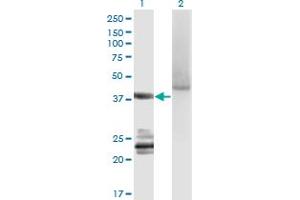 Western Blot analysis of GNA14 expression in transfected 293T cell line by GNA14 monoclonal antibody (M06A), clone 2H8. (GNa14 抗体  (AA 150-250))