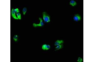 Immunofluorescence staining of MCF-7 cells with ABIN7156768 at 1:66, counter-stained with DAPI. (IL1R2 抗体  (AA 79-219))