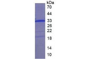 SDS-PAGE analysis of Human Collectin Liver 1 Protein. (COLEC10 蛋白)