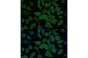 Immunofluorescence (IF) image for anti-Isocitrate Dehydrogenase 1 (NADP+), Soluble (IDH1) (AA 1-414) antibody (ABIN6142143)