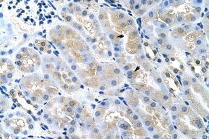 Image no. 1 for anti-Tumor Susceptibility Gene 101 (TSG101) (AA 121-170) antibody (ABIN202410) (TSG101 抗体  (AA 121-170))