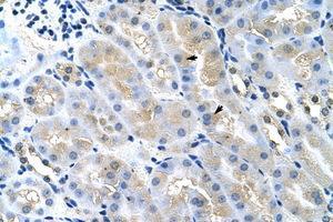Image no. 1 for anti-Tumor Susceptibility Gene 101 (TSG101) (AA 121-170) antibody (ABIN202410) (TSG101 抗体  (AA 121-170))