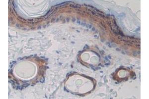 Detection of CD244 in Rat Skin Tissue using Polyclonal Antibody to Cluster of Differentiation 244 (CD244) (2B4 抗体  (AA 20-221))