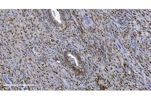 IHC analysis of SAMHD1 using anti-SAMHD1 antibody (ABIN7601514).