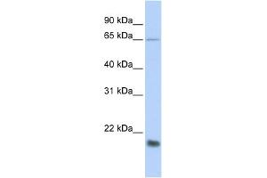 WB Suggested Anti-MUC1 Antibody Titration:  0. (MUC1 抗体  (Middle Region))