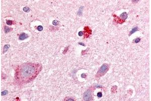 Anti-ROR Beta antibody  ABIN1049297 IHC staining of human brain, cortex. (RORB 抗体  (Hinge Region))