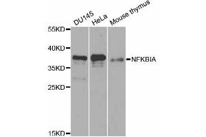 Western blot analysis of extracts of various cell lines, using NFKBIA antibody. (NFKBIA 抗体)