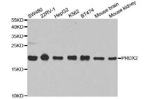 Western blot analysis of extracts of various cell lines, using PRDX2 antibody. (Peroxiredoxin 2 抗体  (AA 1-142))