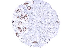 Intense nuclear TRPS1 staining of luminal but not basal breast epithelial cells Dilution 1:20 (Recombinant TRPS1 抗体  (AA 900-1100))