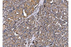 IHC analysis of MLX-interacting protein/MLXIP using anti-MLX-interacting protein/MLXIP antibody (ABIN7602593).