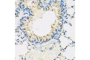 Immunohistochemistry of paraffin-embedded mouse lung using ABCF2 antibody. (ABCF2 抗体  (AA 1-250))