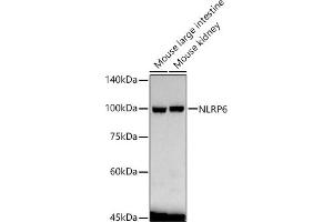 Western blot analysis of extracts of various cell lines, using NLRP6 antibody  at 1:1570 dilution. (NLRP6 抗体  (AA 100-200))