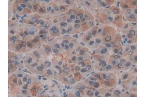 Immunohistochemistry (IHC) image for anti-Macrophage Migration Inhibitory Factor (Glycosylation-Inhibiting Factor) (MIF) (AA 3-111) antibody (ABIN7432415)