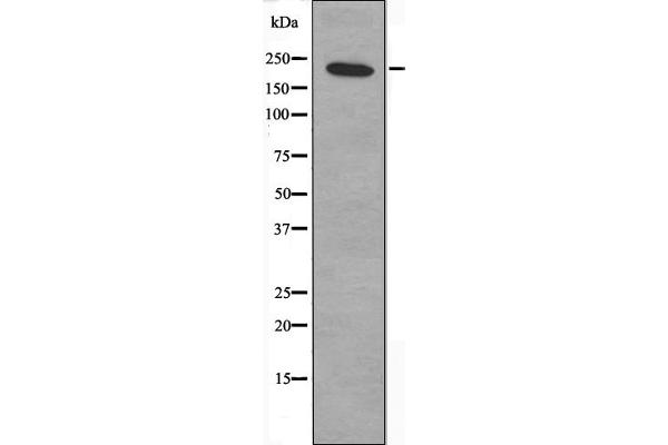 ZNF638 抗体  (Internal Region)
