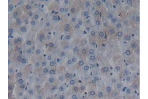 Detection of FMOD in Rat Liver Tissue using Polyclonal Antibody to Fibromodulin (FMOD) (Fibromodulin 抗体  (AA 19-376))