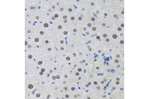 Immunohistochemistry of paraffin-embedded rat liver using MT antibody (ABIN6128251, ABIN6144117, ABIN6144118 and ABIN6222360) at dilution of 1:100 (40x lens). (MTA3 抗体  (AA 40-330))