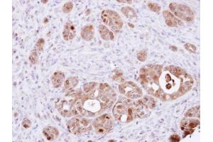 IHC-P Image Immunohistochemical analysis of paraffin-embedded NCIN87 xenograft, using DDT, antibody at 1:100 dilution. (DDT 抗体)