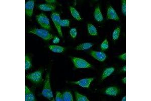 Immunofluorescent analysis of HSP70 staining in Hela cells. (HSP70 抗体)