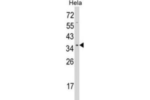 Western Blotting (WB) image for anti-Serine/threonine Kinase Receptor Associated Protein (STRAP) antibody (ABIN3001728) (STRAP 抗体)