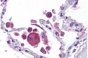 Human Lung: Formalin-Fixed, Paraffin-Embedded (FFPE) (KIT Ligand 抗体  (AA 180-229))