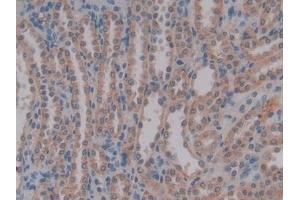 Detection of AMH in Rat Kidney Tissue using Polyclonal Antibody to Anti-Mullerian Hormone (AMH)