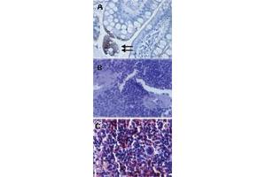 TLR3 Immunohistochemistry. (TLR3 抗体)