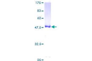 UBE2H Protein (AA 1-183) (GST tag)