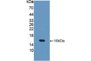 WB of Protein Standard: different control antibodies against Highly purified E. (Occludin ELISA 试剂盒)