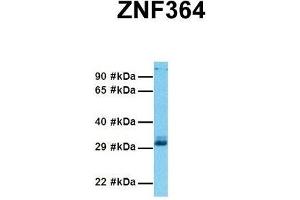 Host:  Rabbit  Target Name:  ZNF364  Sample Tissue:  Human 293T  Antibody Dilution:  1. (RNF115 抗体  (C-Term))