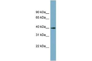 WB Suggested Anti-SLC25A22 Antibody Titration:  0. (SLC25A22 抗体  (N-Term))