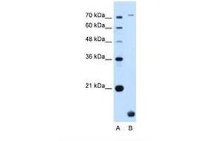 Image no. 1 for anti-Transmembrane Protein 91 (TMEM91) (N-Term) antibody (ABIN6739191) (TMEM91 抗体  (N-Term))