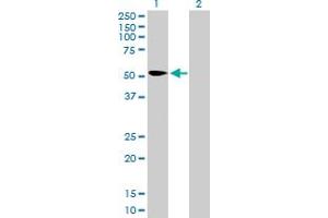 Western Blot analysis of KPNA2 expression in transfected 293T cell line by KPNA2 MaxPab polyclonal antibody. (KPNA2 抗体  (AA 1-529))
