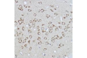 Immunohistochemistry of paraffin-embedded rat spleen using /IB Rabbit pAb (2391) at dilution of 1:50 (40x lens).