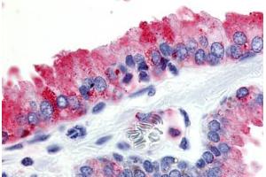 Human Prostate (formalin-fixed, paraffin-embedded) stained with GPR174 antibody ABIN213461 at 10 ug/ml followed by biotinylated goat anti-rabbit IgG secondary antibody ABIN481713, alkaline phosphatase-streptavidin and chromogen. (GPR174 抗体  (Cytoplasmic Domain))
