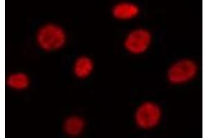 ABIN6275443 staining Hela by IF/ICC. (RANBP17 抗体  (N-Term))