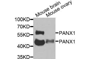 Western blot analysis of extracts of various cell lines, using PANX1 antibody (ABIN6290774) at 1:1000 dilution. (PANX1 抗体)
