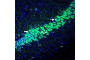 Expression of KChIP2 in mouse hippocampus - Immunohistochemical staining of perfusion-fixed frozen mouse brain sections using Anti-KChIP2 Antibody (ABIN7043296, ABIN7045040 and ABIN7045041), (1:400), followed by goat-anti-rabbit-Alexa-488 (green). (KCNIP2 抗体  (Cytosolic))