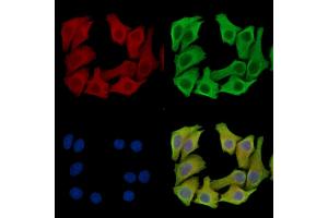 ABIN7096246 and ABIN7100308 staining Hela cells by IF/ICC.