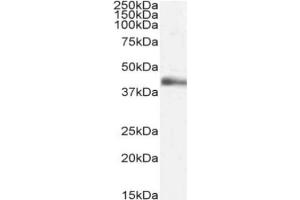 Western Blot using anti-Lymphotoxin alpha antibody 3F12. (Recombinant LTA 抗体)
