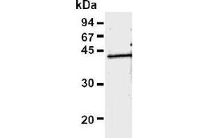 Western Blotting (WB) image for anti-Recombinase A / RecA (AA 260-347) antibody (ABIN1449298) (Recombinase A / RecA (AA 260-347) 抗体)
