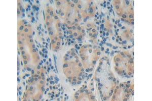 Used in DAB staining on fromalin fixed paraffin- embedded stomach tissue (PTP4A1 抗体  (AA 1-173))