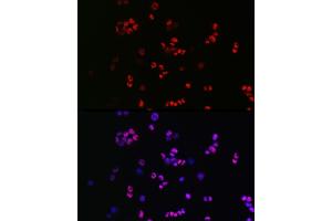 Immunofluorescence analysis of F9 cells using [KO Validated] SOX2 Rabbit pAb (ABIN3021002, ABIN3021003, ABIN3021004 and ABIN6213889) at dilution of 1:50 (40x lens).