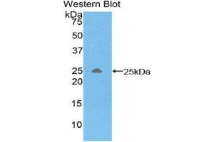 Western Blotting (WB) image for anti-Triggering Receptor Expressed On Myeloid Cells 1 (TREM1) (AA 21-205) antibody (ABIN1860864) (TREM1 抗体  (AA 21-205))