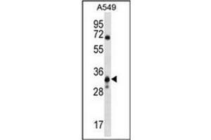 Western blot analysis of MCART6 Antibody (C-term) Cat. (MCART6 抗体  (C-Term))