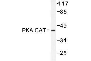 Image no. 1 for anti-V-Akt Murine Thymoma Viral Oncogene Homolog 1 (AKT1) antibody (ABIN272061) (AKT1 抗体)