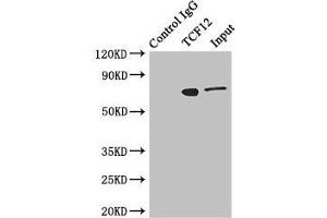 Immunoprecipitating TCF12 in Jurkat whole cell lysate Lane 1: Rabbit control IgG instead of (1 μg) instead of ABIN7172449 in Jurkat whole cell lysate.
