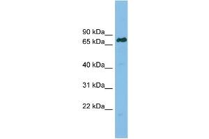 WB Suggested Anti-LBR Antibody Titration: 0. (Lamin B Receptor 抗体  (Middle Region))