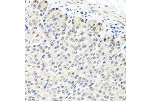 Immunohistochemistry of paraffin-embedded mouse stomach using CNOT8 antibody. (CNOT8 抗体)